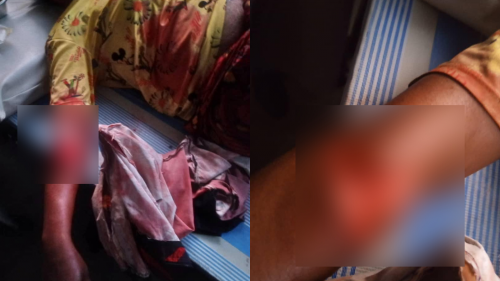 Lawless Nigerian Policemen Stab Woman In Osun State, Brutalise Son Over N100